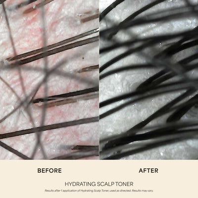 Hydrating Scalp Toner