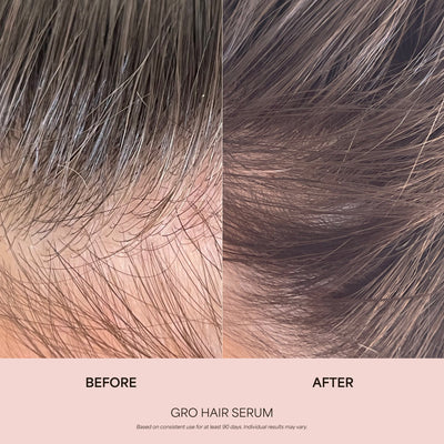 360° Hair Reboot System
