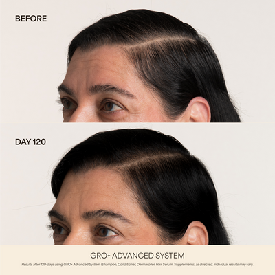 GRO+ Advanced Daily Duo